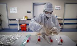 Türkiye'de koronavirüs: 24 saatte 187 can kaybı