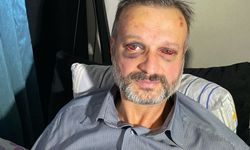 Bursa'da eğlence mekânında darbedilen piyanist yaralandı
