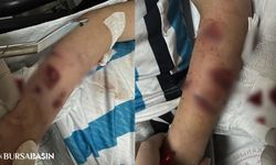 Rize'de 12 Yaşındaki Çocuğa Köpek Saldırısı: Tedavi Altında