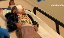 İnegöl’de patlayan torpil, 2 yaşındaki çocuğu yaraladı