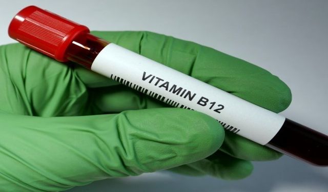 B12 Vitaminini Karşılayacak Besin Nedir Veya Nelerdir?