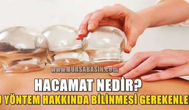 Alternatif Tedavi Yöntemlerinden Birisi Olan Hacamat Hakkında Bilinmesi Gerekenler