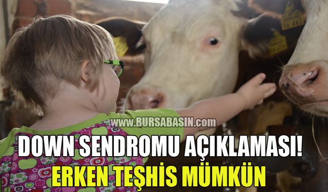 Down Sendromunda Erken Teşhis İçin Gebelik Takibinin Önemi