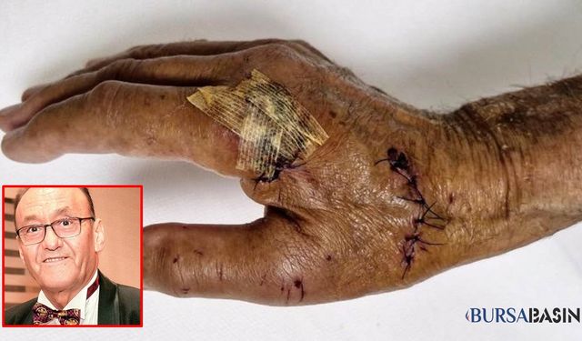 Duş Camı Patladı Emekli Öğretim Üyesi Yaralandı