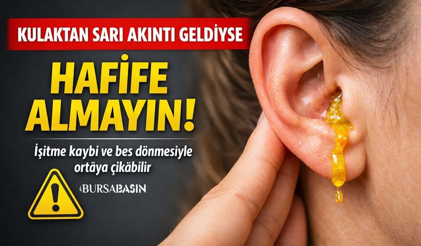 Sarı Kulak Akıntısı Kulak Zarı Deliğinin İşareti