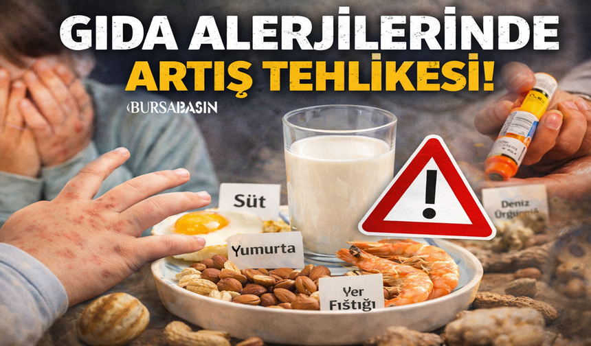 Gıda Alerjisi Her Yaşta Tehlikeli Olabilir